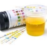 Urinalysis