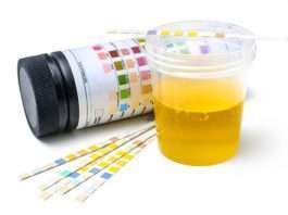 Urinalysis