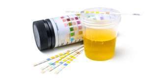 Urinalysis
