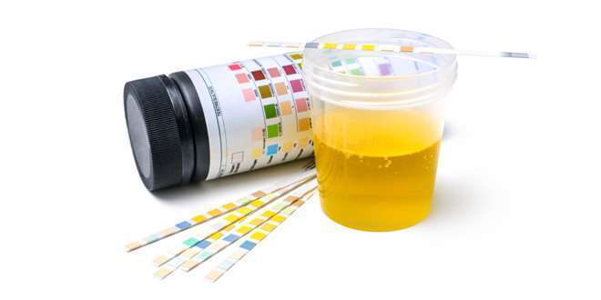 Urinalysis