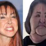 DIY Plastic Surgery