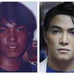 Look Alike Plastic Surgery
