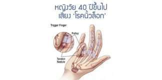โรคนิ้วล็อก
