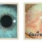 ต่อลม และ ต่อเนื้อ