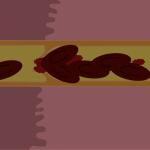 thrombosis
